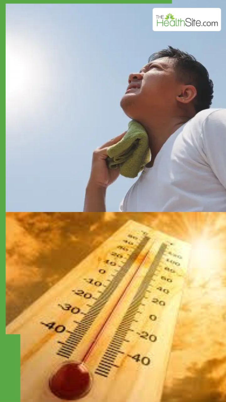 लू लगने पर तुरंत क्या करना चाहिए?