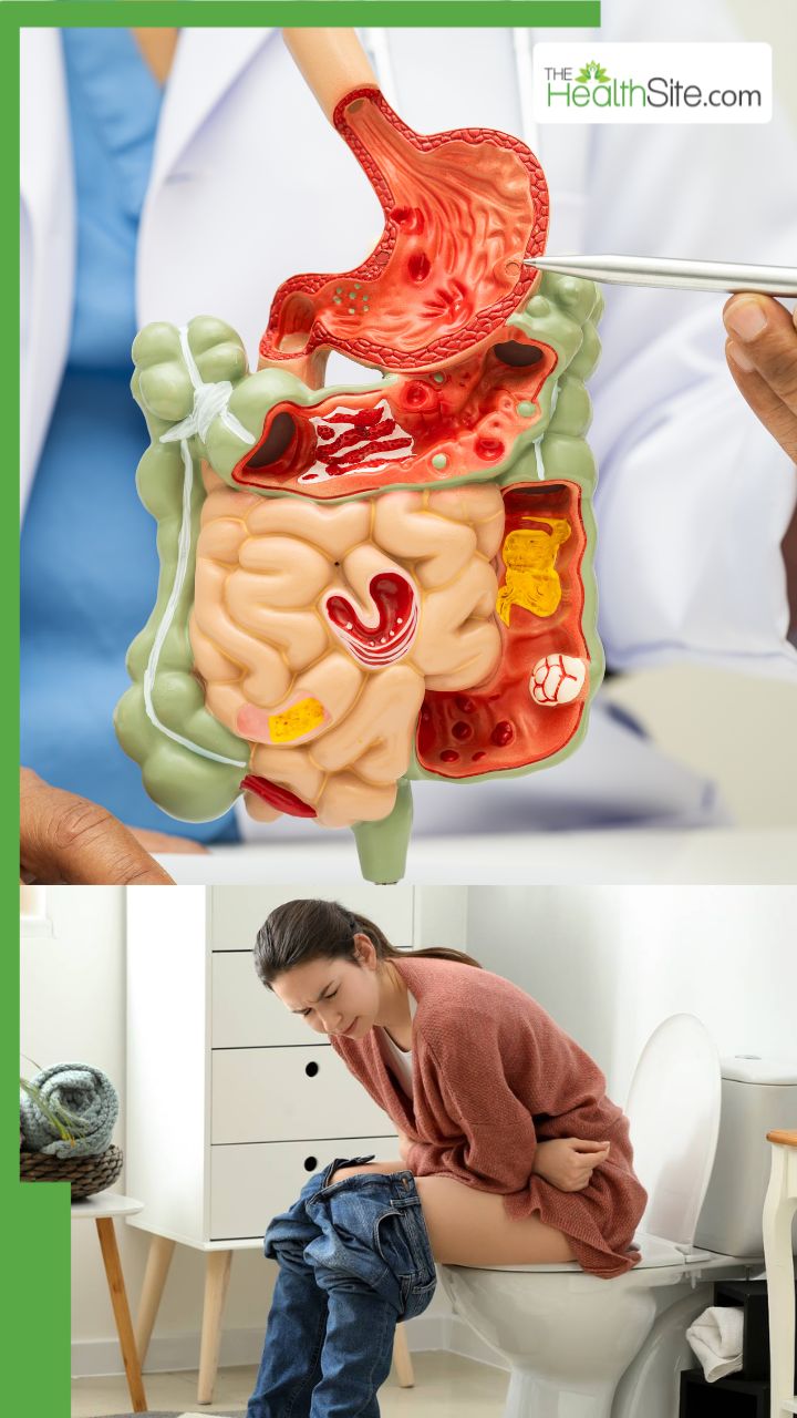 рдЖрдВрддреЛрдВ рдореЗрдВ рдЬрдорд╛ рдорд▓ рдХреЛ рд╕рд╛рдл рдХреИрд╕реЗ рдХрд░реЗрдВ?