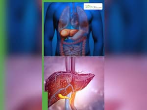 फैटी लिवर और सिरोसिस एक ही हैं या अलग है?