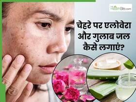 चेहरे पर इन 5 तरीकों से लगाएं से एलोवेरा और गुलाब जल, छूमंतर हो जाएंगे दाग-धब्बे और मुंहासे