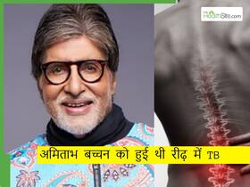 अमिताभ बच्चन को हुआ था स्पाइनल टीबी, जानिए इस बीमारी के लक्षण और उपचार
