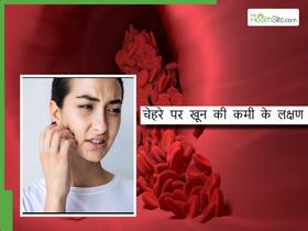 चेहरे पर दिखते हैं खून की कमी के ये 5 लक्षण, स्किन का रंग भी जाता है बदल
