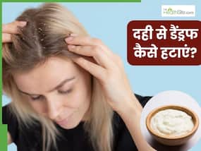 दही से डैंड्रफ कैसे हटाएं? जानें 5 तरीके, जिनसे दूर होगी रूसी और सिर में खुजली की समस्या