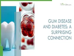 Diabetes And Gum Disease: Understanding The Connection