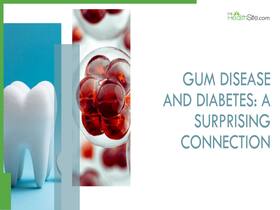 Diabetes And Gum Disease: Understanding The Connection