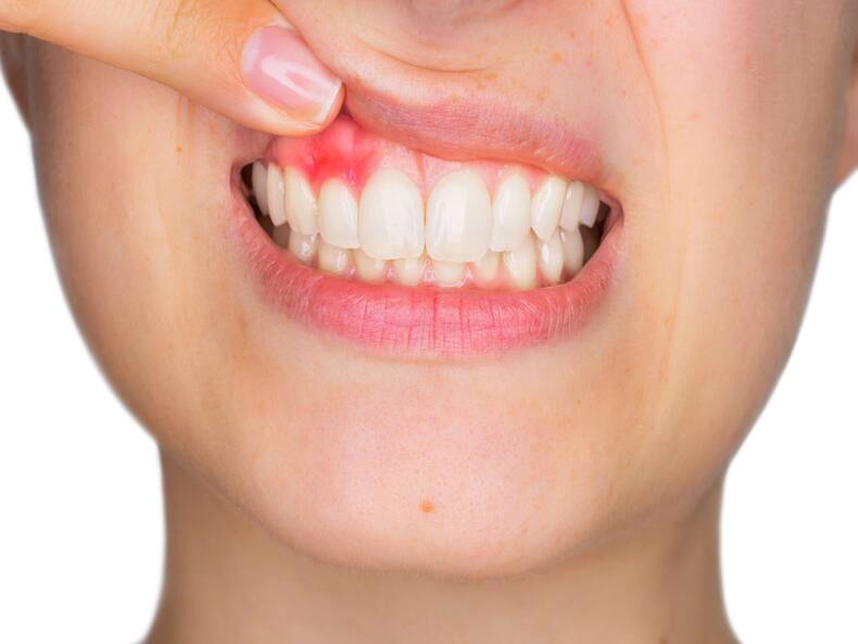 Diabetes And Gum Disease: Understanding The Connection