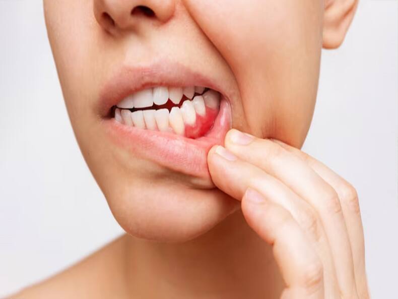 Diabetes And Gum Disease: Understanding The Connection