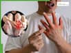 High Uric Acid Home Remedies: 5 Empty Stomach Drinks To Lower High Uric Acid Levels Naturally Without Medication