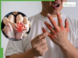 5 Drinks To Lower High Uric Acid Levels Naturally Without Medication