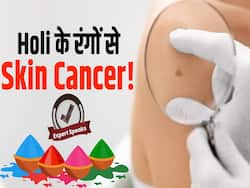 होली के किन रंगों से हैआपको स्किन कैंसर का खतरा?