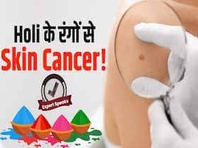 होली के किन रंगों से हैआपको स्किन कैंसर का खतरा?