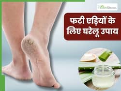 फटी एड़ियों से छुटकारा दिलाएंगे ये 5 घरेलू उपाय, ये 2 चीजें तो हर किसी के किचन में होती हैं मौजूद