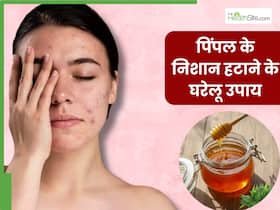 पिंपल्स के दाग-धब्बों से छुटकारा दिला सकती हैं किचन में रखी ये 5 चीजें, लौट आएगा चेहरे का खोया निखार