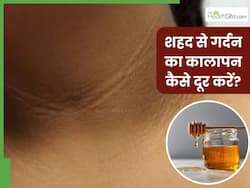 गर्दन का कालापन दूर करने के लिए इन 3 तरीकों करें शहद का इस्तेमाल, हफ्तेभर में दिखने लगेगा असर