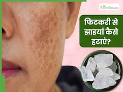 फिटकरी से झाइयां कैसे हटाएं? जानें 5 असरदार तरीके, जिनसे दूर होंगे दाग-धब्बे