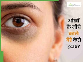 आंखों के नीचे डार्क सर्कल्स कम करेगा एलो वेरा, इन 2 तरीकों से करें इस्तेमाल