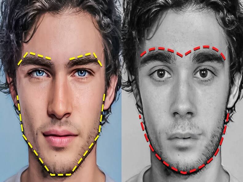 More Men Seeking Facial Contouring: 40% Of Patients Are Male