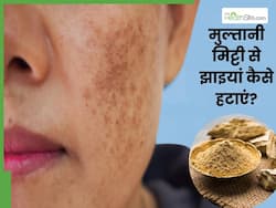 मुल्तानी मिट्टी से झाइयां कैसे हटाएं? जानें 3 तरीके, जिनसे दूर होंगे दाग-धब्बे और कालापन