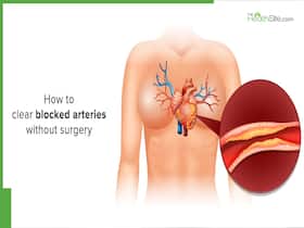 Natural Ayurvedic Drink To Clear Clogged Arteries Natural Ayurvedic Drink To Clear Clogged Arteries