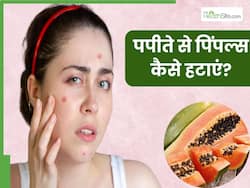 मुंहासों से छुटकारा पाने के लिए इन 3 तरीकों से लगाएं पपीता, हफ्तेभर में दिखने लगेगा रिजल्ट
