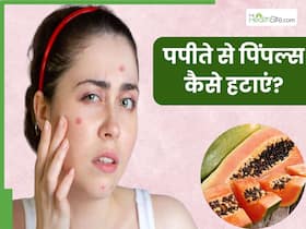 मुंहासों से छुटकारा पाने के लिए इन 3 तरीकों से लगाएं पपीता, हफ्तेभर में दिखने लगेगा रिजल्ट