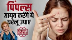 पिंपल्स को गायब करने के लिए फॉलो करें एक्सपर्ट का बताया ये देसी नुस्खा