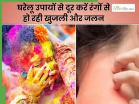 केमिकल वाले रंगों से हो रही है स्किन पर खुजली और जलन तो आजमाएं ये 4 घरेलू उपाय, तुरंत मिलेगी राहत