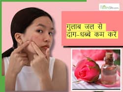 चेहरे के दाग-धब्बे कम करने के लिए  क्रीम नहीं चेहरे पर लगाएं गुलाब जल, कुछ ही दिनों में चमक उठेगी स्किन