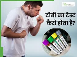 टीबी का टेस्ट कैसे होता है? डॉक्टर से जानें कितने प्रकार की होती है टीबी की जांच