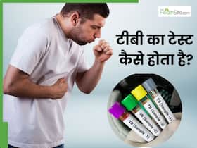टीबी का टेस्ट कैसे होता है? डॉक्टर से जानें कितने प्रकार की होती है टीबी की जांच टीबी का टेस्ट कैसे होता है? डॉक्टर से जानें कितने प्रकार की होती है टीबी की जांच