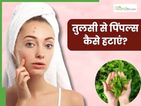 तुलसी से पिंपल्स कैसे हटाएं? जानें 5 तरीके, जिनसे मिलेगी निखरी-बेदाग त्वचा