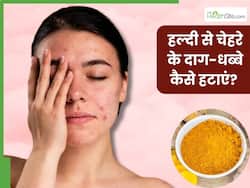 चेहरे के दाग-धब्बे हटाने के लिए इन 3 तरीकों से करें हल्दी का इस्तेमाल, निखर उठेगी त्वचा