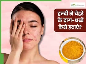 चेहरे के दाग-धब्बे हटाने के लिए इन 3 तरीकों से करें हल्दी का इस्तेमाल, निखर उठेगी त्वचा