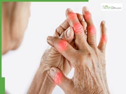 Understanding Early-Onset Arthritis In Young People: Causes And Treatment
