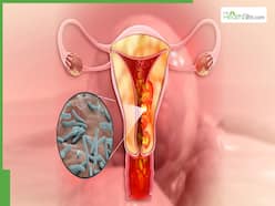 Understanding Uterine Tuberculosis: Symptoms, Pregnancy Impact, And Treatment