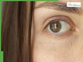Unveiling Madarosis: Restoring Eyebrows And Eyelashes Beyond Aesthetics