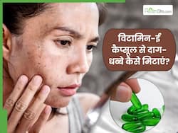 चेहरे के दाग-धब्बे मिटाने में असरदार है विटामिन-ई कैप्सूल, इन 4 तरीकों से करें इस्तेमाल