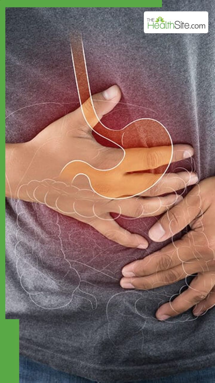 एसिडिटी होने पर क्या खाएं?