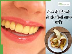 दांतों का पीलापन साफ करेगा केले का छिलका, इस तरह से करें इस्तेमाल