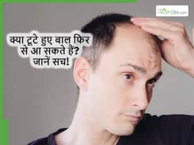 क्या इन आयुर्वेदिक दवाओं से टूटे हुए बाल भी आ सकते हैं वापस? आयुर्वेद एक्सपर्ट से जानें असली सच