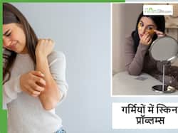 गर्मियों में इन 5 स्किन प्रॉब्लम्स का रहता है रिस्क, ये हैं बचाव के उपाय
