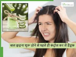 हेयर फॉल का सबसे बड़ा कारण बन सकता है डैंड्रफ, इन 4 नुस्खों से पाएं Dandruff से छुटकारा