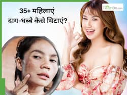 एक्ने मार्क्स और डार्क स्पॉट्स से भर गया है चेहरा, तो इन 2 घरेलू नुस्खों से कम करें दाग-धब्बे