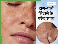 चेहरे के काले दाग-धब्बों से परेशान हैं, तो अपनाएं ये 4 घरेलू उपाय, मिट जाएगा सारा कालापन