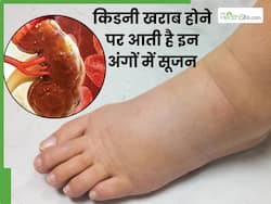 किडनी खराब होने से महीनों पहले इन 2 अंगों में आने लगती है सूजन, बार-बार टूटती है रात की नींद