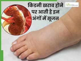 किडनी खराब होने से महीनों पहले इन 2 अंगों में आने लगती है सूजन, बार-बार टूटती है रात की नींद