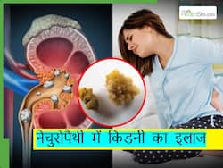 किडनी स्टोन्स या पथरी के लिए नेचुरोपैथी में हैं ये सस्ते इलाज, साइड-इफेक्ट्स का भी नहीं है चांस