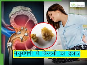 किडनी स्टोन्स या पथरी के लिए नेचुरोपैथी में हैं ये सस्ते इलाज, साइड-इफेक्ट्स का भी नहीं है चांस