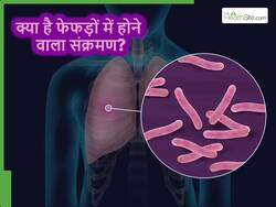 Lung Infection: рдХреНрдпрд╛ рд╣реЛрддрд╛ рд╣реИ рдлреЗрдлрдбрд╝реЛрдВ рдореЗрдВ рд╣реЛрдиреЗ рд╡рд╛рд▓рд╛ рд╕рдВрдХреНрд░рдордг рдФрд░ рдпрд╣ рдХрд┐рд╕ рдХрд╛рд░рдг рд╕реЗ рд╣реЛрддрд╛ рд╣реИ, рдПрдХреНрд╕рдкрд░реНрдЯреНрд╕ рд╕реЗ рдЬрд╛рдирд┐рдП