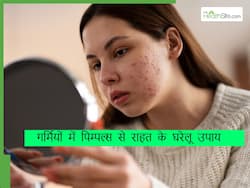 गर्मियों में पिम्पल्स कम करने के लिए स्किन पर लगाएं ये चीजें, स्किन भी होगी साफ